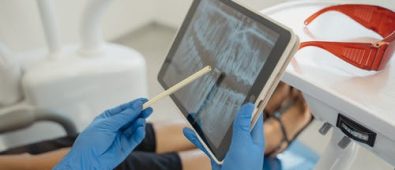 5 Frequent Procedures in Dental Surgery