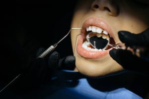 Read more about the article Saving Your Smile: The Surprising Benefits of Emergency Dentistry