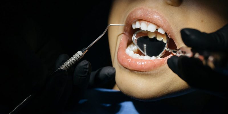 Saving Your Smile: The Surprising Benefits of Emergency Dentistry