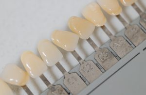 The Ultimate Guide to Maintaining Oral Health During Pregnancy