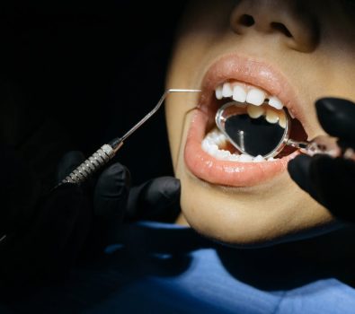 Saving Your Smile: The Surprising Benefits of Emergency Dentistry